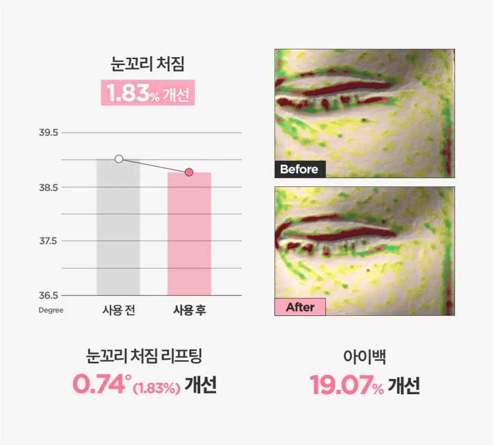 [1+1 / 눈밑+눈꼬리 동시케어] 해서린 PDRN 아이 리프팅 마이크로 딥패치 1+1 기획 상세페이지 18
